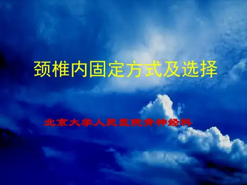 颈椎内固定