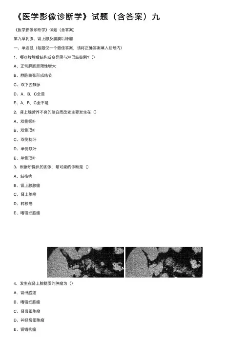 《医学影像诊断学》试题（含答案）九
