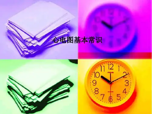 心电图基本常识-PPT课件