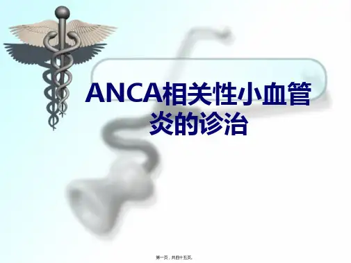 ANCA相关性小血管炎的诊治