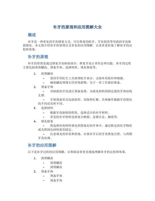 补牙的原理和应用图解大全