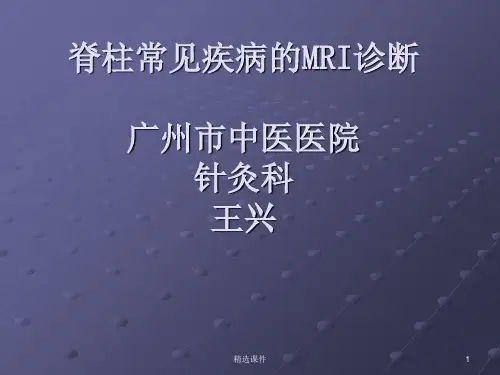 脊柱正常MRI表现及常见疾病
