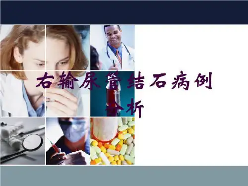 右输尿管结石病例分析培训课件