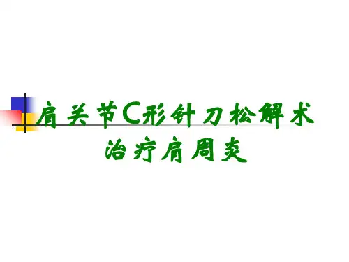 肩关节C形针刀松解术治疗肩周炎