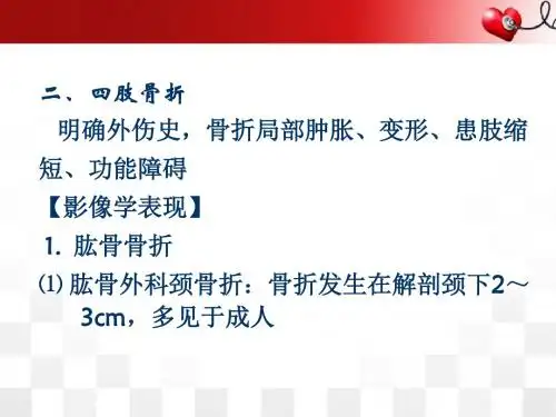 (医学课件)四肢骨折-影像诊断