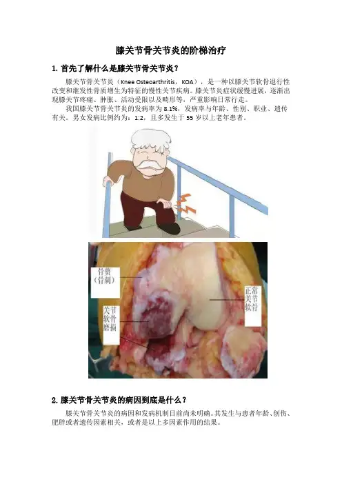 膝关节骨关节炎的阶梯治疗