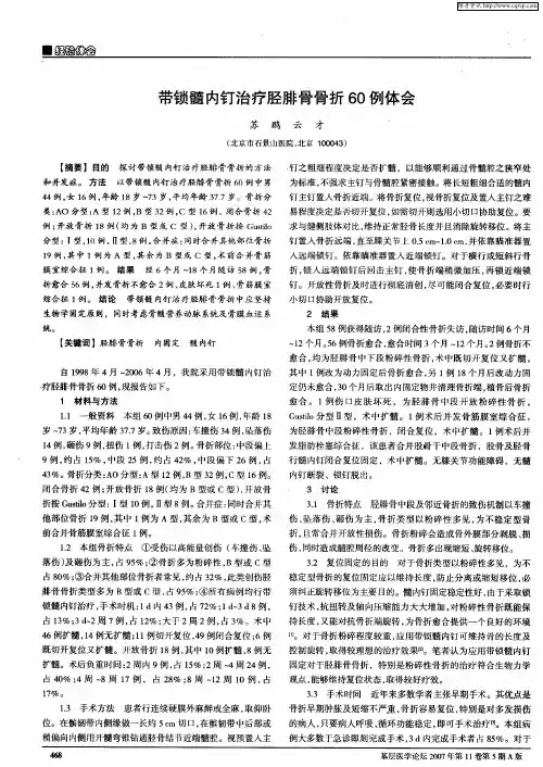 带锁髓内钉治疗胫腓骨骨折60例体会