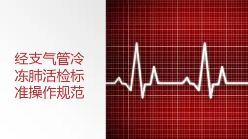 经支气管冷冻肺活检标准操作规范