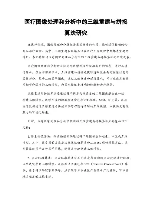 医疗图像处理和分析中的三维重建与拼接算法研究