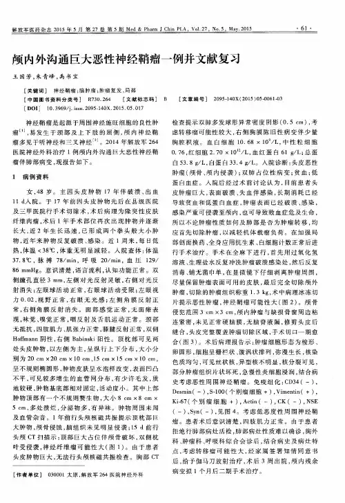 颅内外沟通巨大恶性神经鞘瘤一例并文献复习