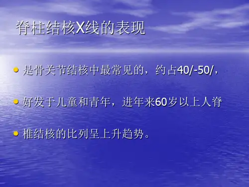 脊柱结核的X线表现(精)ppt课件