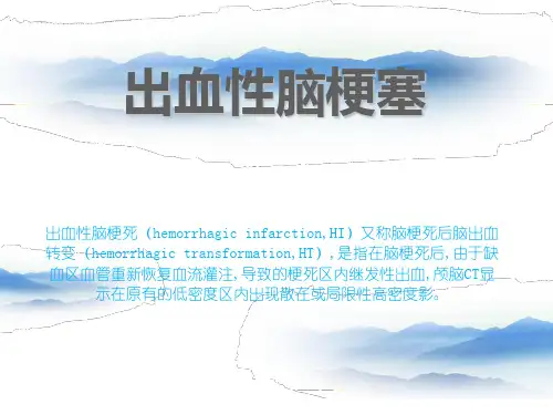 出血性脑梗塞  ppt课件