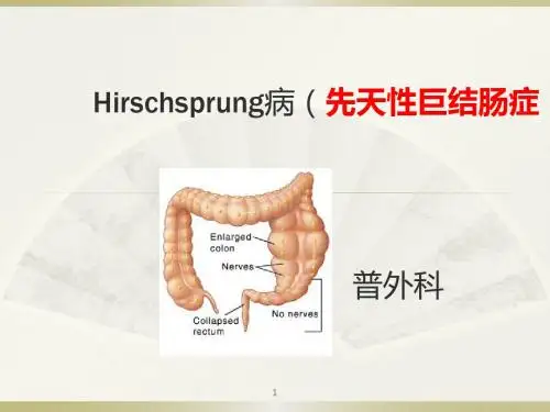 先天性巨结肠症查房(Hirschsprung病)PPT幻灯片课件