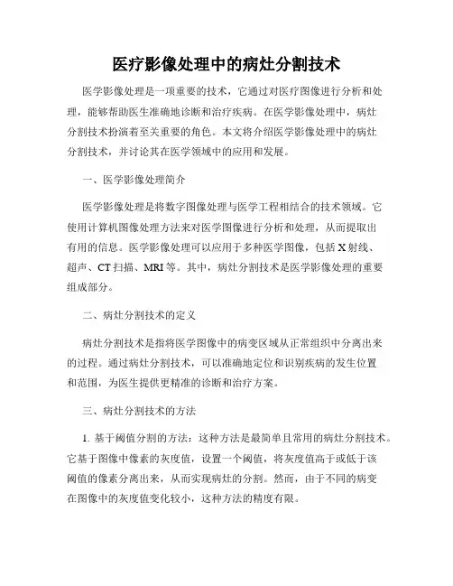 医疗影像处理中的病灶分割技术