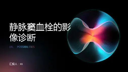 静脉窦血栓的影像诊断