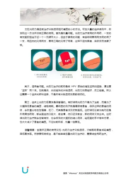 艾拉光动力治疗尖锐湿疣好吗