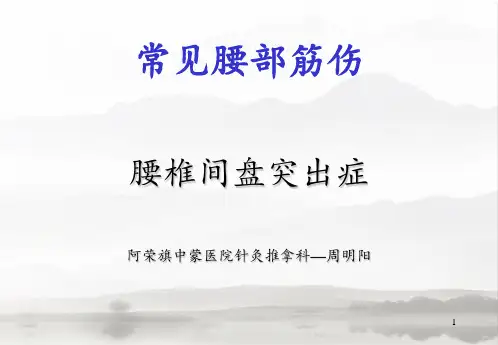 常见腰部筋伤—腰椎间盘突出症PPT课件