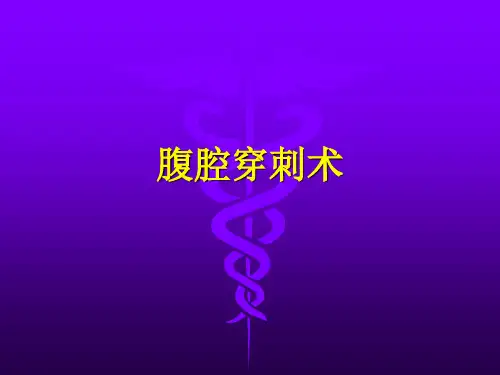 腹腔穿刺术