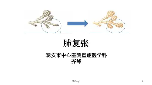 齐峰肺复张