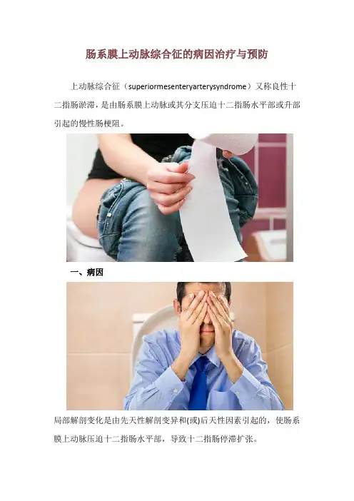 肠系膜上动脉综合征的病因治疗与预防