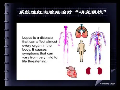 系统性红斑狼疮药