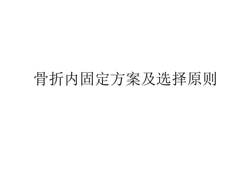 骨折内固定方案及选择原则