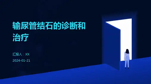 输尿管结石的诊断和治疗