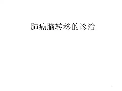 肺癌脑转移的诊治课件