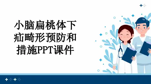 小脑扁桃体下疝畸形预防和措施PPT课件
