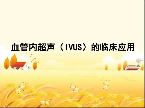 血管内超声(IVUS)的临床应用