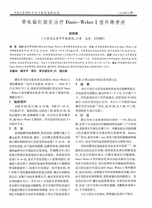 带线锚钉固定治疗Danis-WeberⅠ型外踝骨折