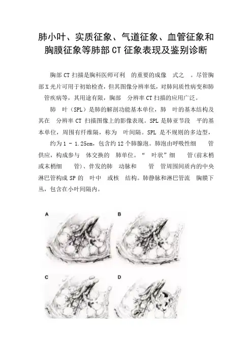 肺小叶、实质征象、气道征象、血管征象和胸膜征象等肺部CT征象表现及鉴别诊断