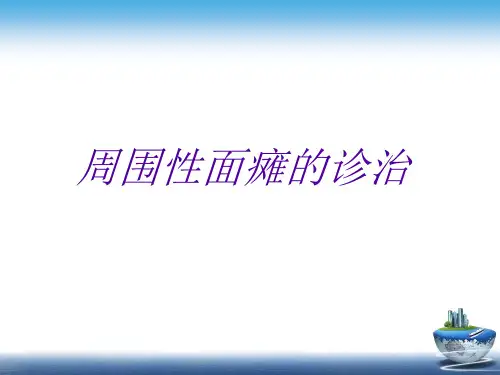 面瘫中西医诊治PPT课件