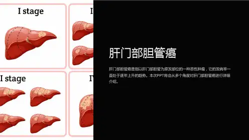 《肝门部胆管癌》课件