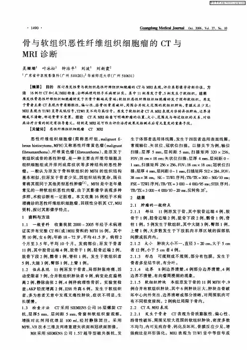骨与软组织恶性纤维组织细胞瘤的CT与MRI诊断