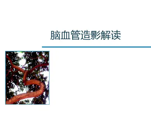 脑血管造影解读课件