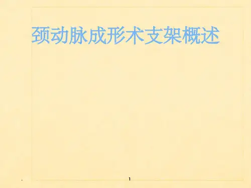 颈动脉支架概述