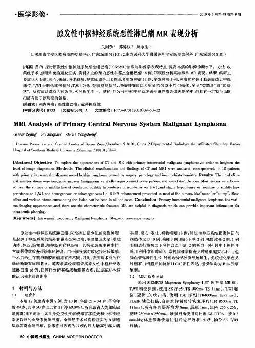 原发性中枢神经系统恶性淋巴瘤MR表现分析