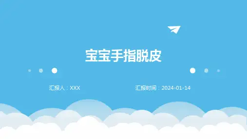 宝宝手指脱皮疾病演示课件