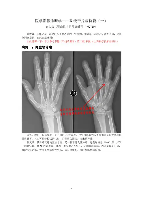 医学影像诊断学——X线平片病例篇(一)