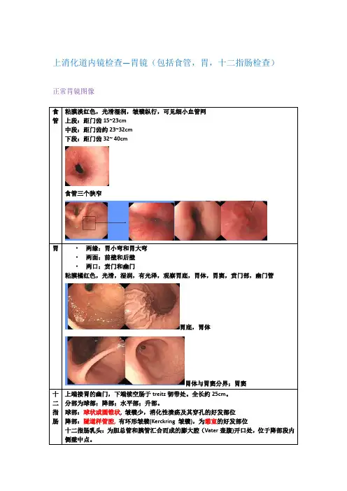 诊断学-内镜检查