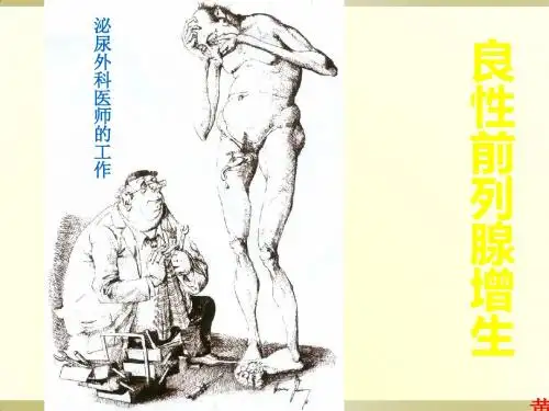 前列腺增生-课件(PPT演示)