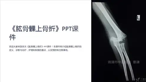 《肱骨髁上骨折》课件