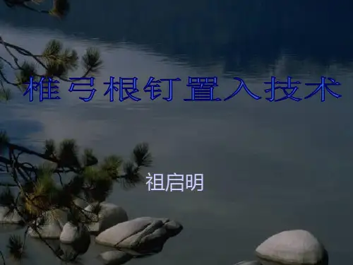 椎弓根钉置入技术1