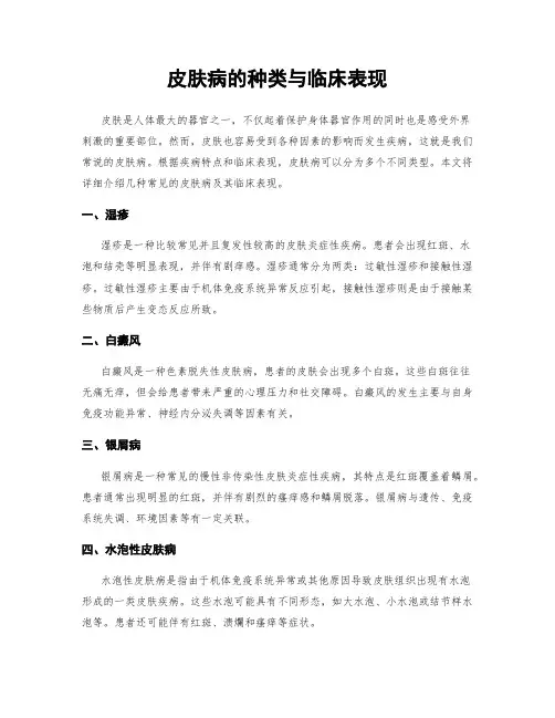 皮肤病的种类与临床表现