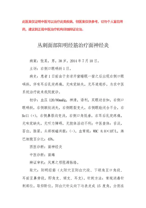 中医医案——面神经炎(二)