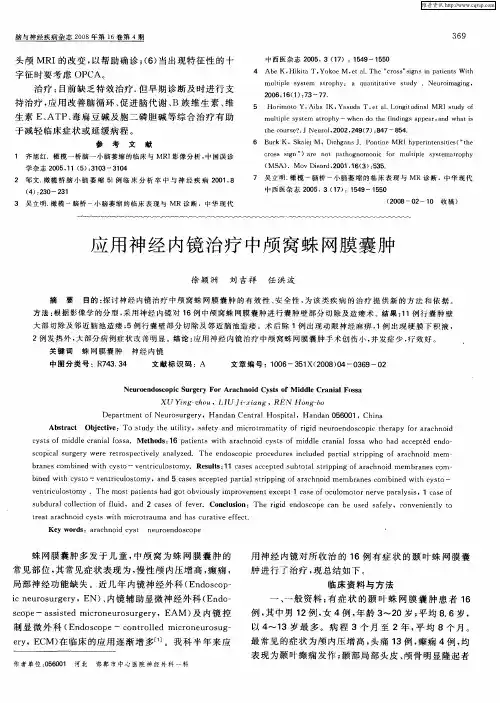 应用神经内镜治疗中颅窝蛛网膜囊肿