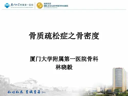 骨质疏松症之骨密度骨今中外