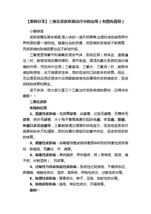 【案例分享】三氧在皮肤疾病治疗中的应用（有图有真相）