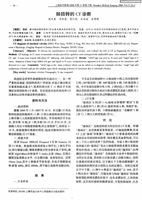 肠扭转的CT诊断